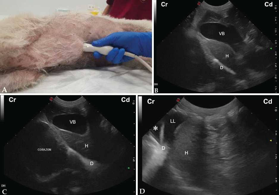 (A) Posicionamiento de la sonda de ecografía para obtener la vista subxifoidea. (B) Imagen ecográfica del área hepatodiafragmática (HD) de un perro sano en la que se observa el hígado (H) y la vesícula biliar (VB) en corte longitudinal y el diafragma (D). Cr: craneal; Cd: caudal. (C) Imagen ecográfica del área hepatodiafragmática (HD) de un perro sano a mayor profundidad, en la que se observa el corazón y la zona distal del diafragma (D), además del hígado (H) y de la vesícula biliar (VB) en corte longitudinal. Cr: craneal; Cd: caudal. (D) Imagen ecográfica del área hepatodiafragmática de un gato con linfoma multicéntrico, en la que se observa la presencia de líquido libre anecogénico (LL) entre el diafragma (D) y el hígado (H), además de en el espacio pleural (asterisco). Cr: craneal; Cd: caudal.