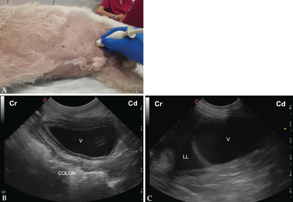 (A) Posicionamiento de la sonda de ecografía para obtener la vista caudal. (B) Imagen ecográfica del área cistocólica (CC) de un perro sano, en la que se observa la vejiga (V) y el colon en corte longitudinal. Cr: craneal; Cd: caudal. (C) Imagen ecográfica del área cistocólica (CC) de un perro con hemoabdomen, en la que se observa la presencia de líquido libre anecogénico (LL) cranealmente a la vejiga (V). Cr: craneal; Cd: caudal.