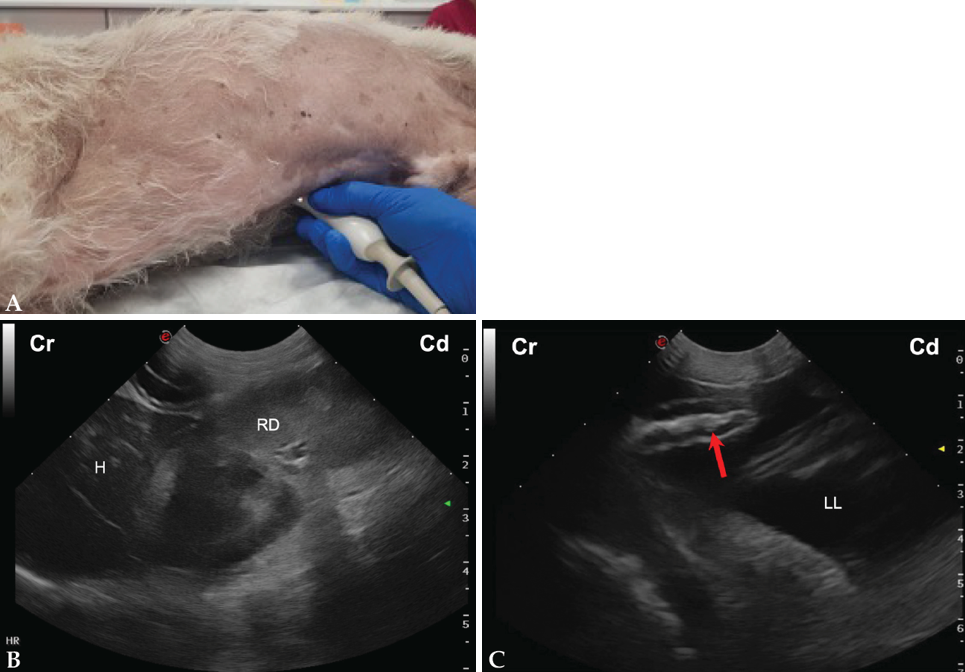 (A) Posicionamiento de la sonda de ecografía para obtener la vista del flanco derecho. (B) Imagen ecográfica del área hepatorrenal (HR) de un perro sano, en la que se observa el hígado (H) y el riñón derecho (RD) en corte longitudinal. Cr: craneal; Cd: caudal. (C) Imagen ecográfica de asas de intestino delgado obtenida de un perro con hemoabdomen durante la realización de la vista hepatorrenal, en la que se observa la presencia de moderada cantidad de líquido libre anecogénico (LL) entre las mismas, además de su corrugación (flecha roja). Cr: craneal; Cd: caudal.&nbsp;